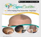 Alopecia Calvicie Tratamiento Con Micropigmentacion Capilar